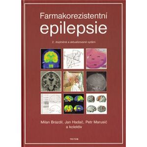 Farmakorezistentni epilepsie - Petr Marusič, Milan Brázdil, Jan Hadač