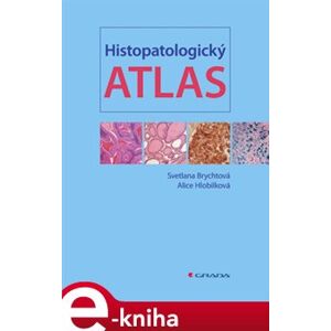 Histopatologický atlas - Svetlana Brychtová, Alice Hlobilková e-kniha