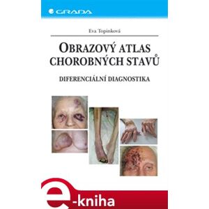 Obrazový atlas chorobných stavů. Diferenciální diagnostika - Eva Topinková e-kniha