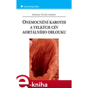 Onemocnění karotid a velkých cév aortálního oblouku - Bohuslav Čertík e-kniha