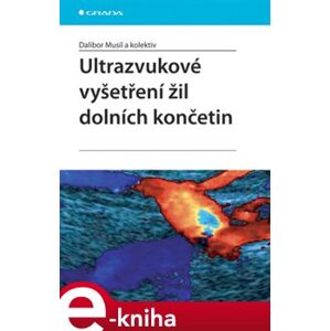 Ultrazvukové vyšetření žil dolních končetin - Dalibor Musil e-kniha