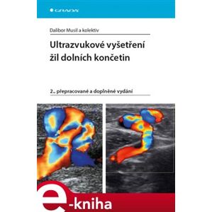 Ultrazvukové vyšetření žil dolních končetin. 2., přepracované a doplněné vydání - Dalibor Musil e-kniha