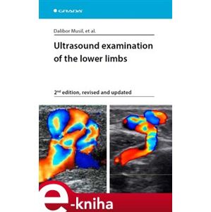 Ultrasound examination of the lower limbs. 2nd edition, revised and updated - Dalibor Musil e-kniha