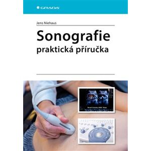 Sonografie - praktická příručka - Jens Niehaus