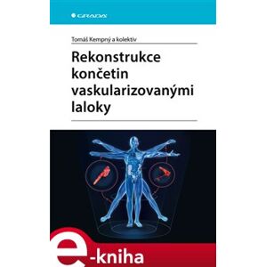 Rekonstrukce končetin vaskularizovanými laloky - kol., Tomáš Kempný e-kniha
