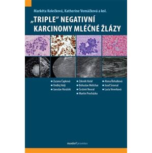 „Triple“ negativní karcinomy mléčné žlázy - Markéta Kolečková