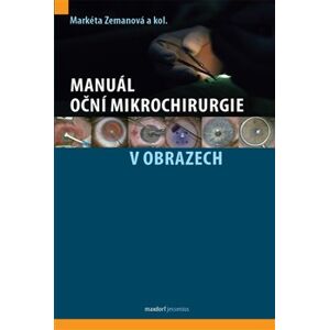 Manuál oční mikrochirurgie v obrazech - kol., Markéta Zemanová