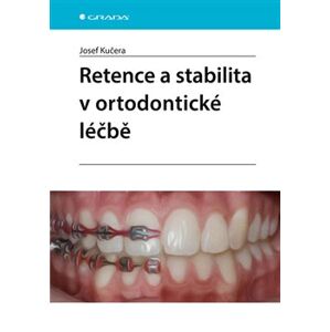 Retence a stabilita v ortodontické léčbě - Josef Kučera