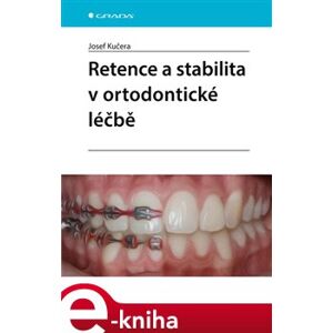 Retence a stabilita v ortodontické léčbě - Josef Kučera e-kniha